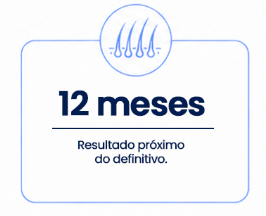 12 Transplante Capilar FUE