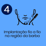 4 Transplante de Barba