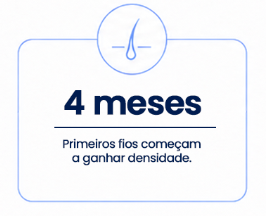 4 Transplante Capilar FUE