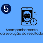 5 Transplante de Barba