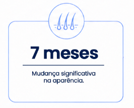 7 Transplante Capilar FUE