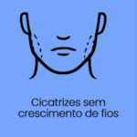 Barba4 Transplante de Barba