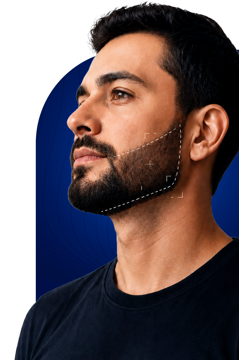 barba Transplante de Barba