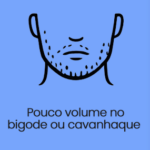 barba2 Transplante de Barba